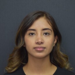 Rinoplastia 2 Rodolfo Uribe Valle